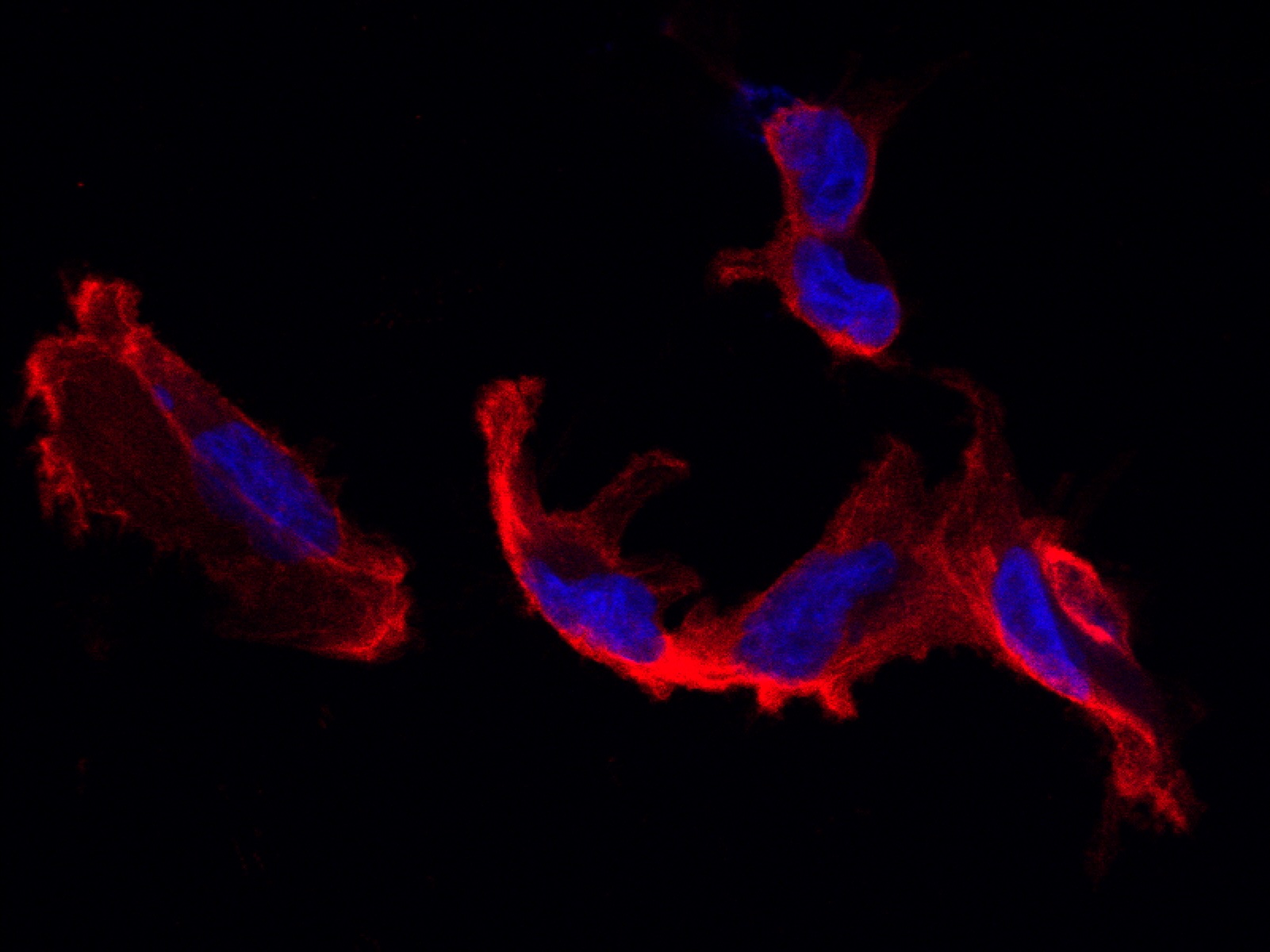 Fluorescence microscopy — Oncovirology Laboratory
